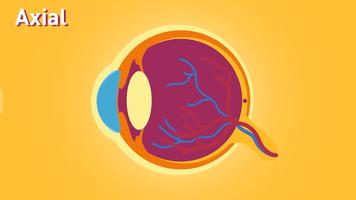 古代人近视怎么办动画,古代人近视了怎么治疗的