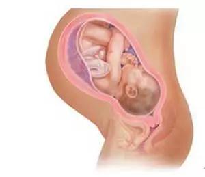 头胎剖腹产二胎就不能顺产？又一例成功逆袭，VBAC了解一下