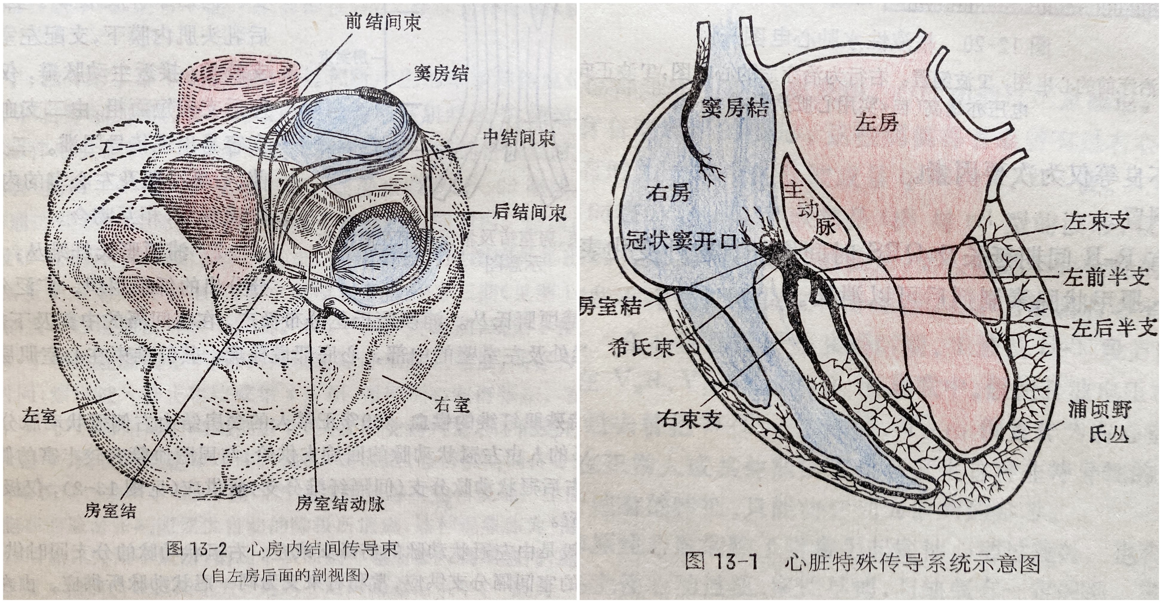 心电图查出心脏有阻滞是怎么回事,心电图查出右束支传导阻滞