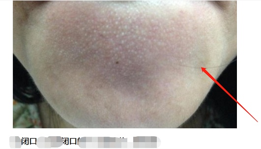 你知道什么是闭口吗,闭口和不是闭口