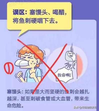 骨鲠,消化内镜可以做什么治疗