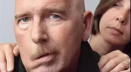 如何拯救面瘫脸无表情,如何才能拯救我的脸