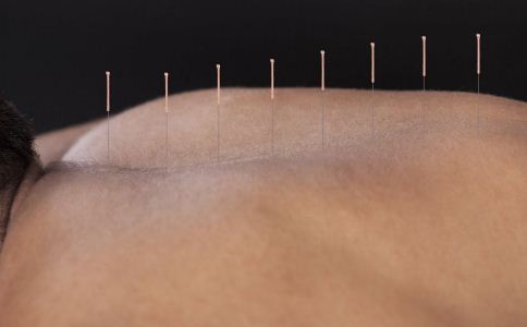 针灸各种疾病对应穴位,精神类疾病能针灸治疗吗