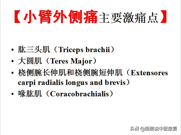 激痛点挂图,激痛点疗法笔记