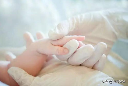 新生儿脑瘫的10个征兆图片,新生儿脑瘫一般是什么原因引起