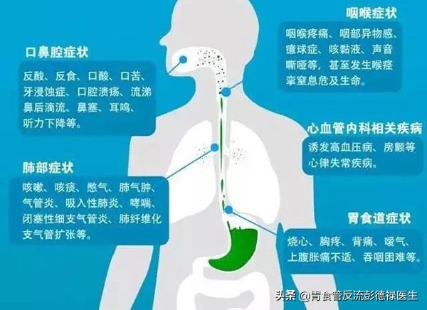 晚饭吃多了半夜胃难受怎么办,晚饭吃多了后到半夜就胃不舒服
