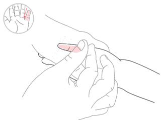 儿童哮喘成人哮喘,儿童哮喘发病率有多高