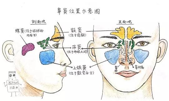 麝香矾石散治疗儿童鼻窦炎,儿童鼻窦炎息肉的治疗方法