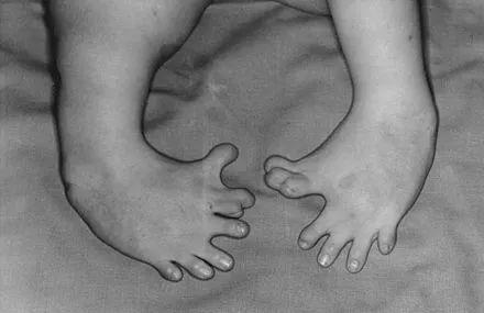 老药新用途成功案例,老药新用合集