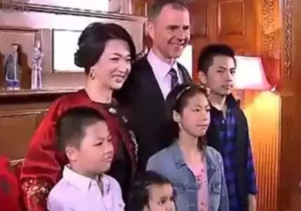 37针不打麻药，翻开皮肉剔除毛囊，做变性手术的金星曾有多痛苦？