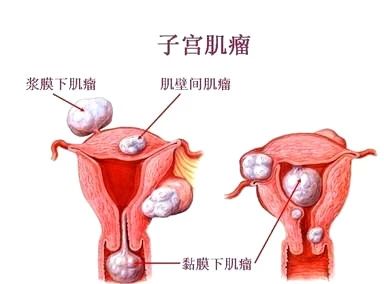 做宫颈分泌物能查出白带异常吗,白带异常要做宫颈筛查吗