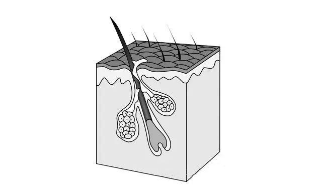 皮肤出油多如何抑制出油,皮肤出油怎么保湿效果好