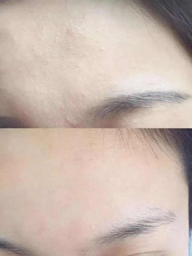 takami美容液效果怎么样,takami黑头水