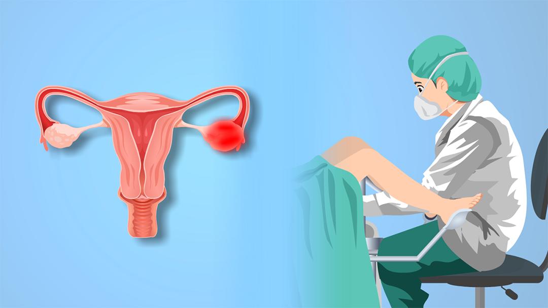 腹痛白带异常,腹部疼痛白带多的原因慢性盆腔炎