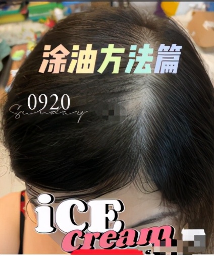 蓖麻油可以用来护发吗,蓖麻油薄荷油治疗脱发