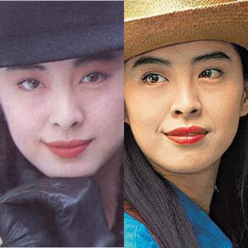 塌鼻梁鼻头大整容会有副作用吗,塌鼻梁凸嘴高颧骨整容