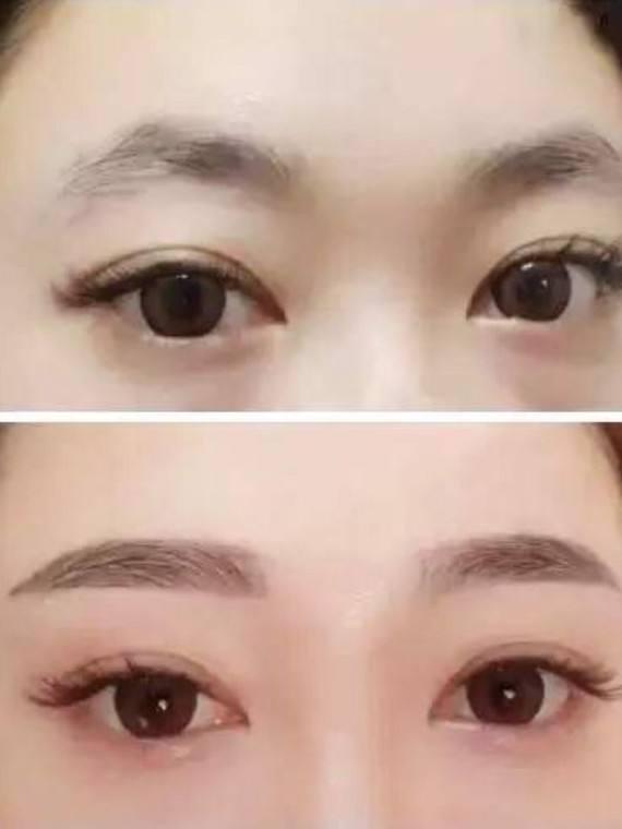 有一种整容叫明星卸妆,整容后素颜化妆对比