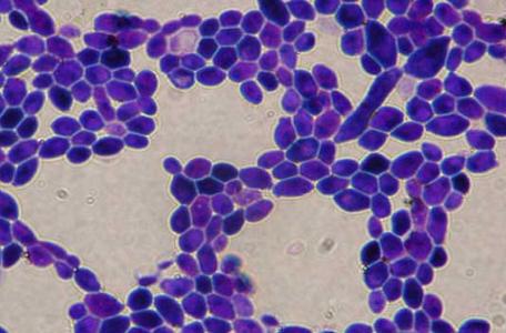 妇科病：白带异常是多种疾病的警示信号，应对方案及调节方法