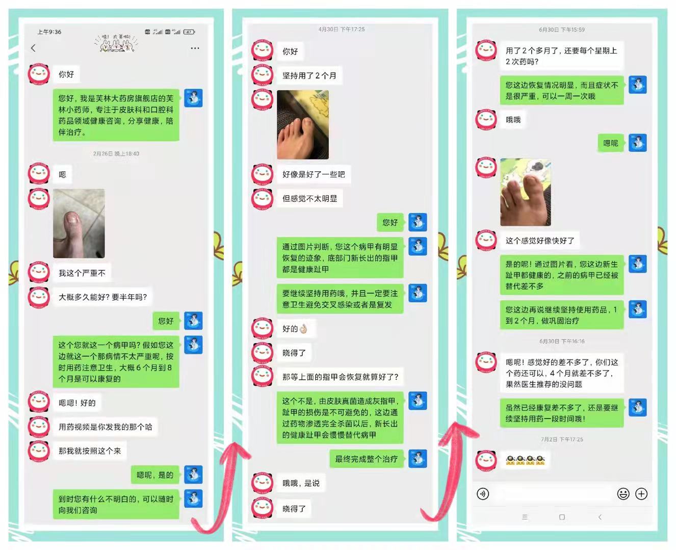 灰指甲初期涂药可以治好吗,怎样治好灰指甲的最快方法