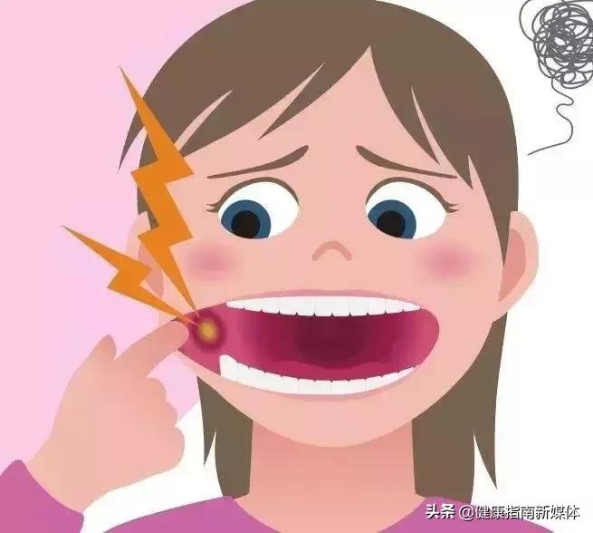 如何治疗口腔溃疡及牙龈肿痛,口腔溃疡怎么治疗