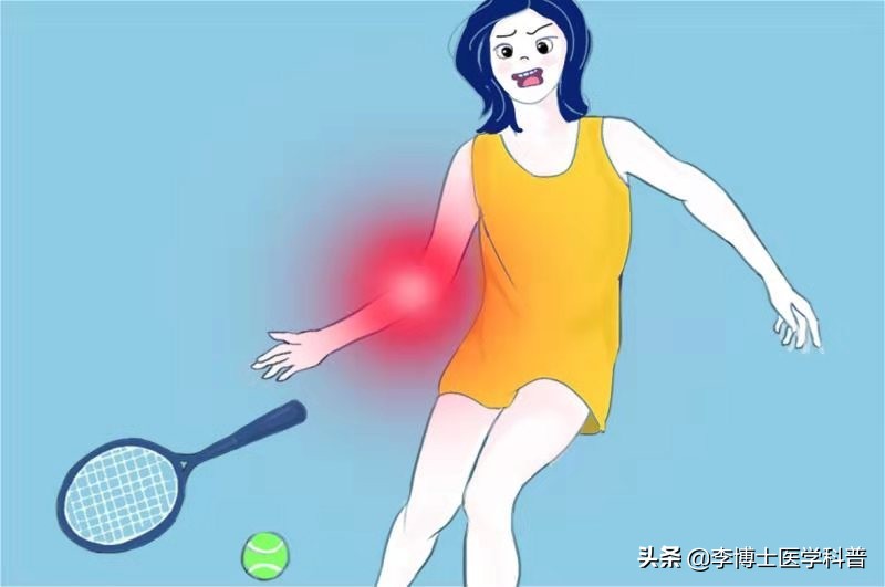 原创漫画教你八种方法治疗“网球肘”-----给你带来不一样的疗效