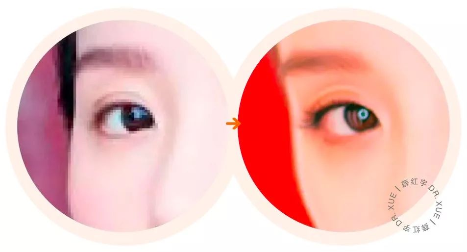 睫毛卷翘的方法半永久,睫毛卷翘定型