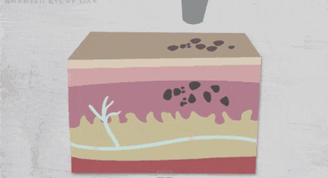 激光美容小知识,激光美容会不会导致脸部下垂