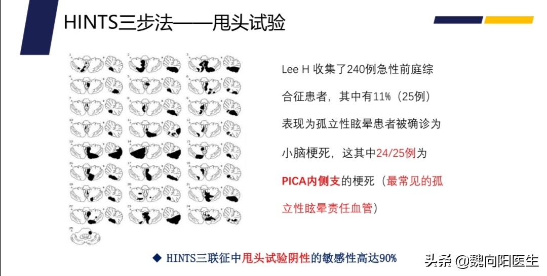 治疗眩晕头晕哪个医院好,头晕眩晕中医看什么科