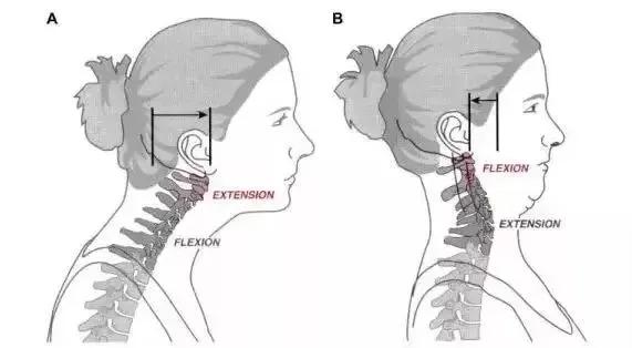 直角肩才是显瘦的关键！常练这几个体式，你就是行走的“衣架子”