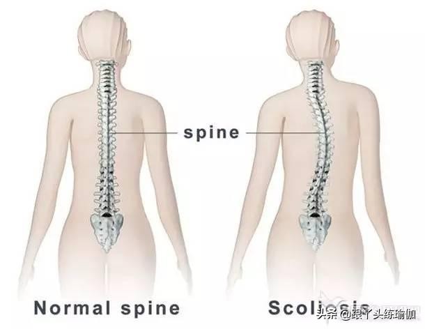 高低肩也能蜕变为背影杀手？这套瑜伽矫正姿势要常练