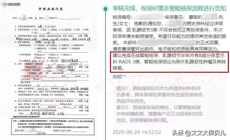 医院查出来有结节还能买保险吗,结节切了能买保险吗