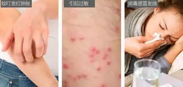 日本的变态杀蚊子神器,日本蚊子驱蚊神器