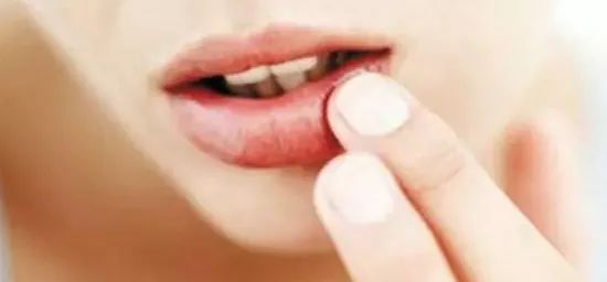 孕期嘴角起小水泡最快消除方法,孕早期嘴角起大水泡最快消除方法