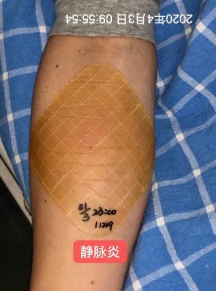 病人拒绝治疗护士怎么办,患者拒绝打留置针可以吗