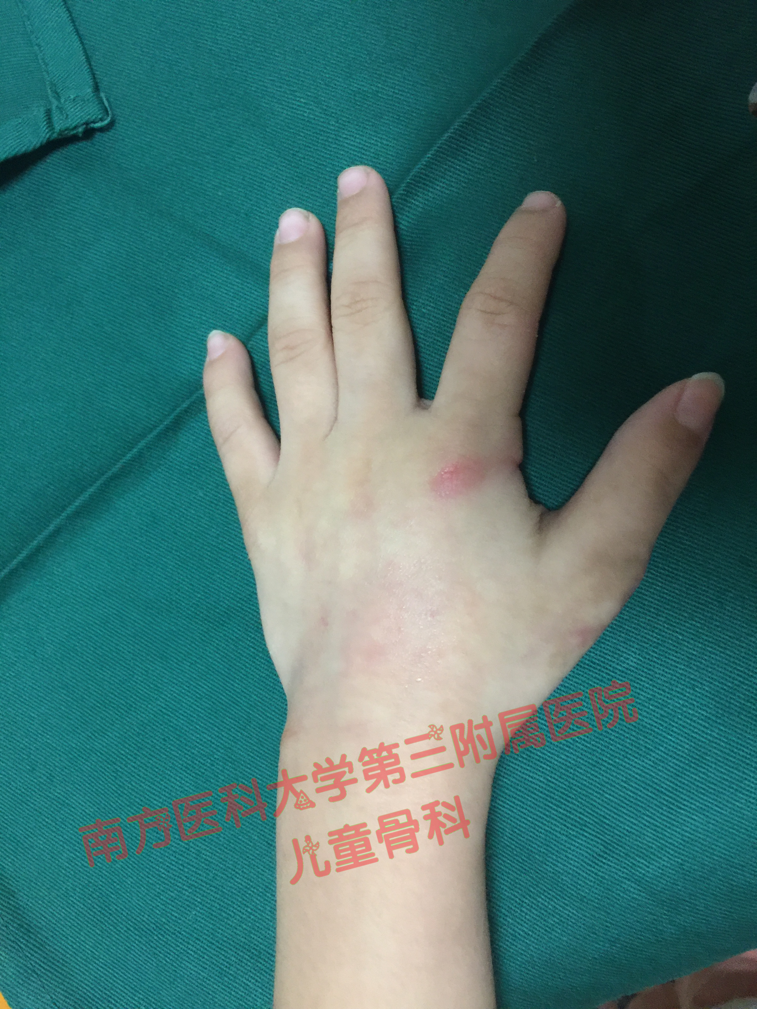 宝宝住院一个人怎么照顾,宝宝手术住院需要带什么东西