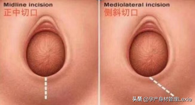 产后要重视产妇的身体恢复,产后修复需要重视起来