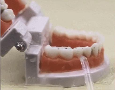 用冲牙器冲的牙很酸,用冲牙器后牙缝更大了