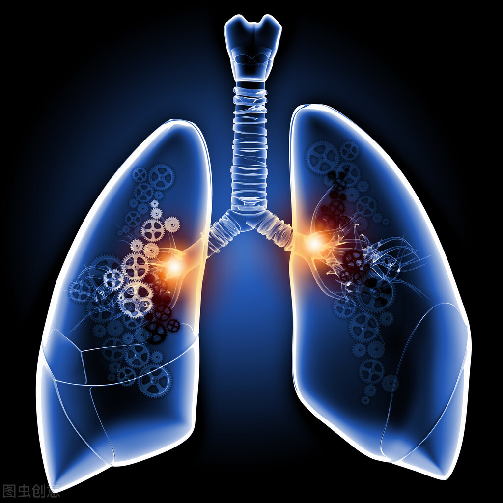 十大肺癌进口特效药,有哪些可以发现肺癌的特效药