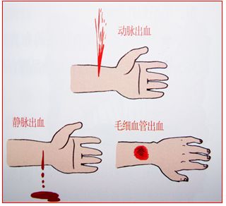 伤口撒盐的时候,伤口撒盐正确吗