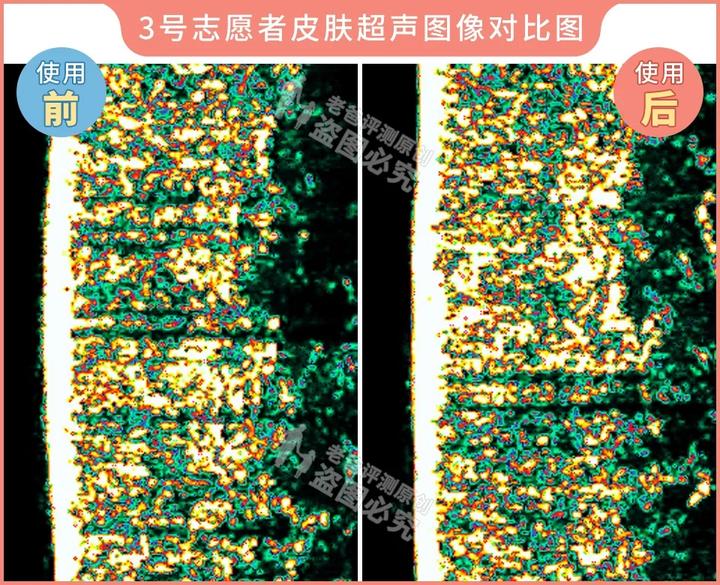 300块的网红美容仪有效果吗,网红家用美容仪测评