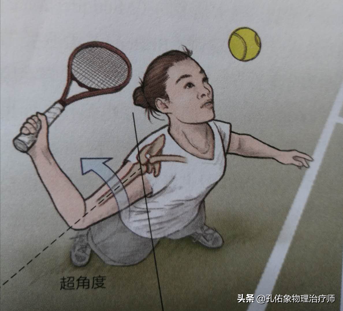 什么原因引起肩周炎手臂活动受限,引起肩周炎疼痛是什么原因