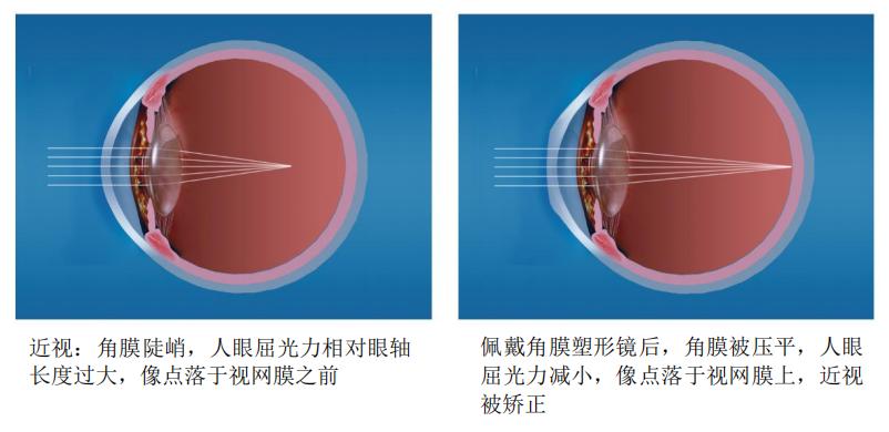 小晶体，大视界这家企业为无数患者带来光明