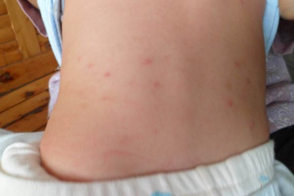 奶奶天天给宝宝穿脏衣服,宝宝一换洗衣服就起疹子