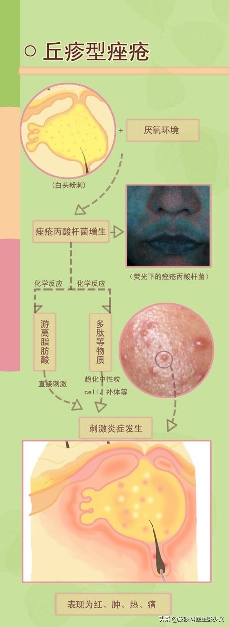 痘疮怎么治疗最快啊,身体长痘长疮怎么办最快消除