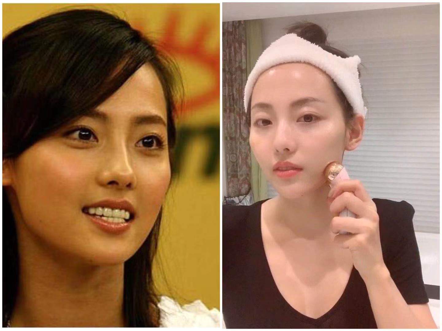 19岁女生打“美容针”脸肿得像包子，到医院检查，医生怒斥：无知