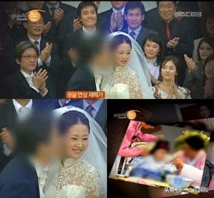 47岁申恩庆图片,47岁申恩庆削骨现状