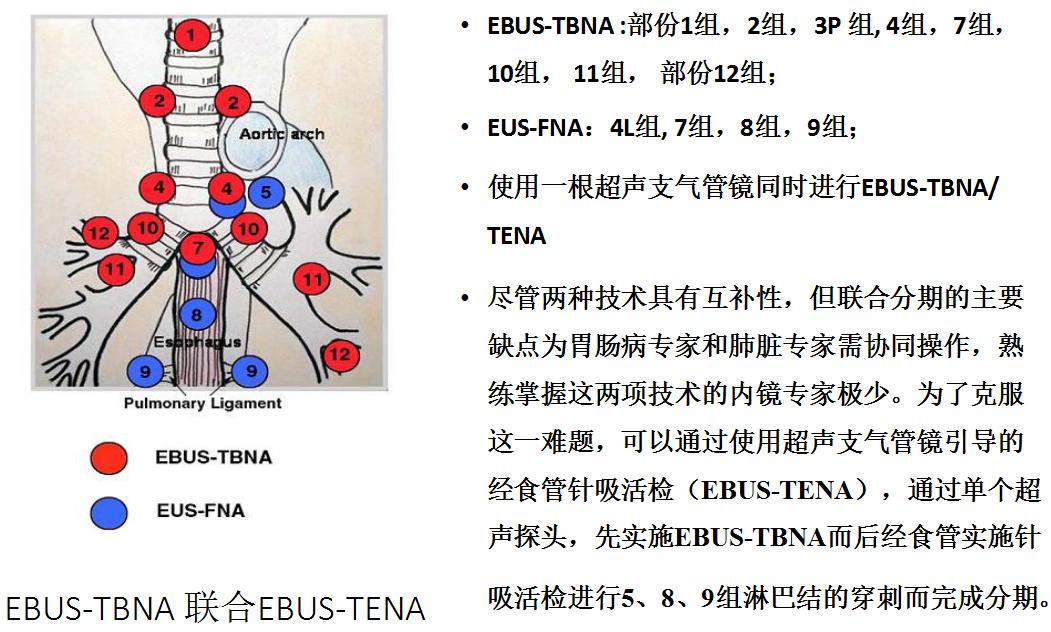支气管镜高频电刀治疗中央型肺癌,支气管镜在早期肺癌诊断的意义