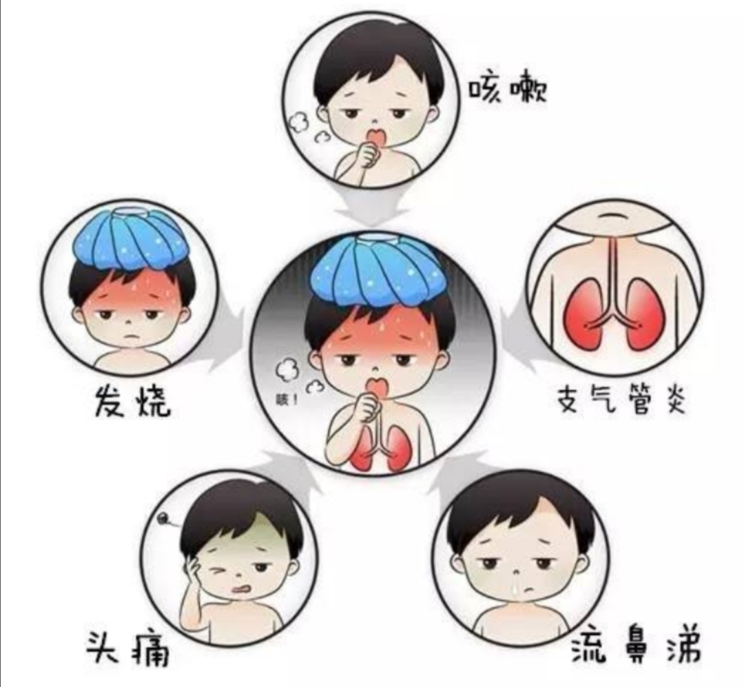 沈阳儿童流感爆发,流感爆发的应急处置措施