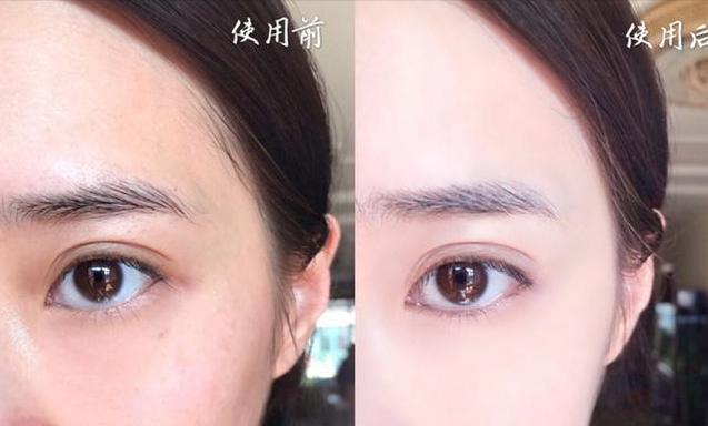 戚薇推荐水乳套装平价,戚薇推荐的水乳油皮