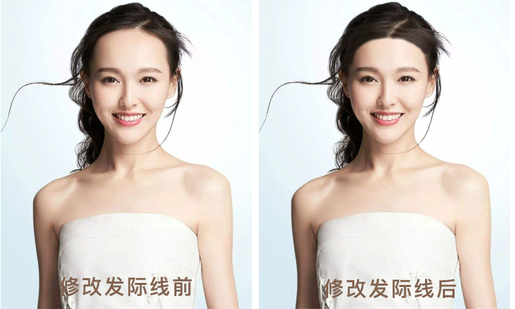 发际线到底怎样才好看,为什么有人的发际线好看